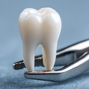 Extracting a tooth may be more affordable up front but can cost more in the long run